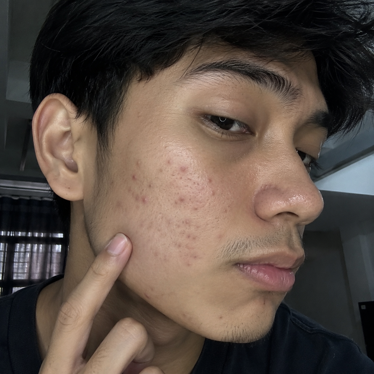 CUURA_Bad_Skin_Day_Male.png