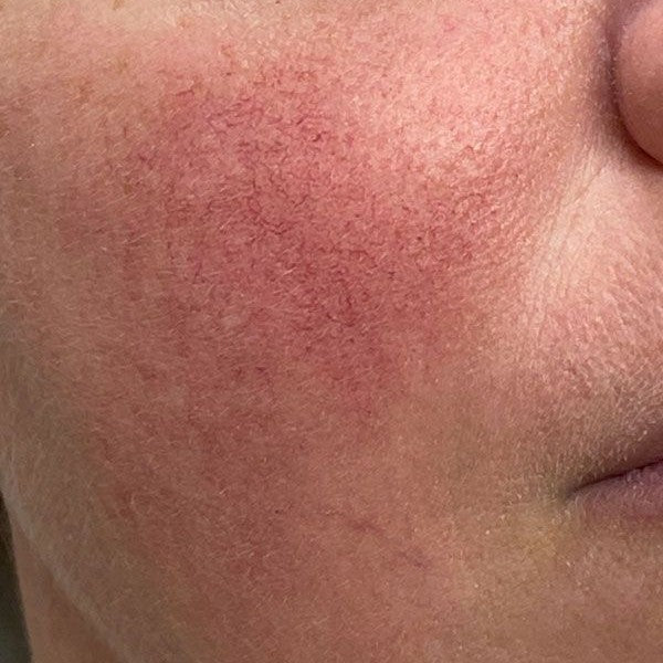Treatments_for_Sun_Spots_7265ab7c-c549-40cf-b3ea-3d26c529dc63.jpg